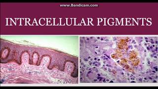 Intracellular pigments [upl. by Angelo]