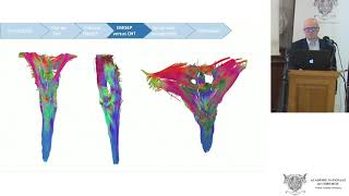 Imagerie par Tenseur de Diffusion et Tractographie médullaire [upl. by Hayikaz]