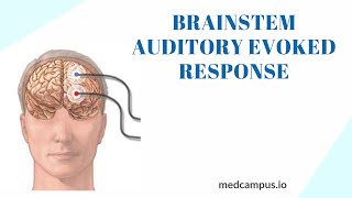 BAER Brainstem Auditory Evoked Response Test [upl. by Aserehc]