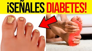 Síntomas de Diabetes en los Pies  Reconoce las Señales Tempranas [upl. by Ynnavoeg976]