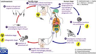 Leishmaniasis anthroponotic life cycle [upl. by Woods]