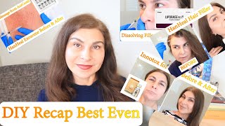 Monthly DIY Recap Innotox HanHeal Exosome Liporase HanHeal Hair Filler  PDOThreadsDIY [upl. by Beckie566]