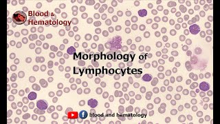 Morphology of Lymphocytes [upl. by Innis]