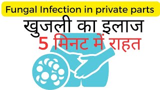 Fungal infection in private parts home remedy in Hindi [upl. by Bomke]