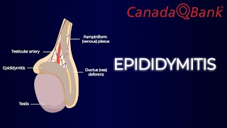 Epididymitis [upl. by Kolosick]