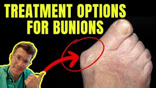 TOP 13 Ways to Shrink Bunions Naturally 1 HUGE SECRET [upl. by Jarlathus]