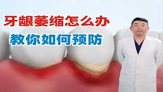 牙龈萎缩怎么办，教你如何预防！ [upl. by Biddie]