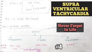 SupraVentricular tachycardia  Arrythmia in ECG  Cardiac arrythmia in hindi [upl. by Roselle]