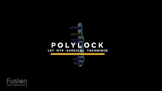 PolyLock MTP Surgical Technique [upl. by Lleda921]