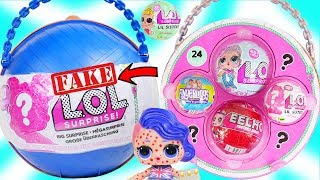 LOL Surprise Doll visit Giant fake Big Surprise ball Unicorn for Lil Sisters Chickenpox  Toy Video [upl. by Esirehs712]