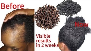 Do not make this hair tea of youre not ready for fast hair growth   Only two ingrefor fast growth [upl. by Viccora]