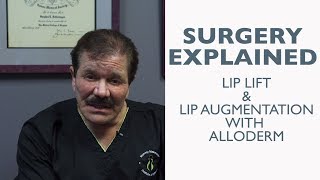 Dr Schlesinger Explains Lip Lift and Augmentation with Alloderm  Not Graphic [upl. by Anemolihp]