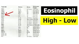 EOSINOPHIL COUNT  CAUSES OF HIGH and LOW LEVELS [upl. by Liss678]