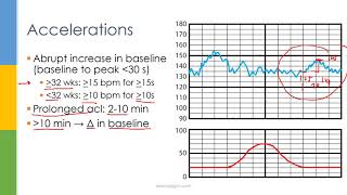 Learn OBGYN Fetal Heart Rate Monitoring  Nonstress Test [upl. by Seravaj]