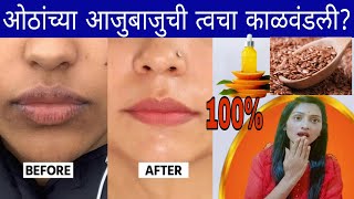 ओठांच्या आजुबाजुची त्वचा काळवंडलीREMOVE DARKNESS AROUND MOUTH AT HOME Pigmentation [upl. by Sedgewinn]