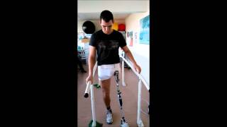 First time on prosthetic leg with hip disarticulation [upl. by Darla]