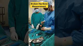 Broken Hip Bone Live  hipbone hipfracture hipreplacementsurgery hippaintreatment hippain hip [upl. by Karil]