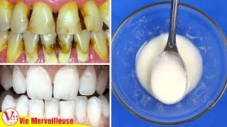 Comment Enlever Tartre En 2 Minutes  Utiliser Ce Mélange Pour Obtenir Des Dents Blanches Naturelles [upl. by Zola954]