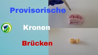 Provisorische Kronen und Brücken mit Patientenfall  Versorgungsabdruck  kein Langzeitprovisorium [upl. by Zipnick]