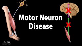 Motor Neuron Disease Animation [upl. by Ifen]