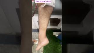 Thompsons test special test of lower leg Achilles tendon rupture special test diagnosisshorts [upl. by Cozza]