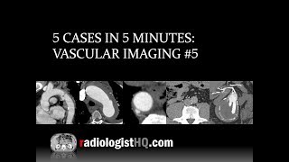 5 Cases in 5 Minutes Vascular 5 [upl. by Nnaer]