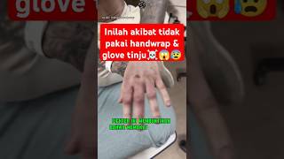 Jgn coba² gk pake glove klo GK mau kek gini ☠️😰 boxing boxingskill fight mma bangghalyh [upl. by Ahsirk375]