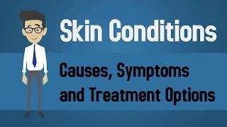 Skin Conditions  Causes Symptoms and Treatment Options [upl. by Annatnas555]