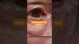 Eyelids twitch sometime problem आखिर क्या होता हैंeyes twitch amazingfacts health medical [upl. by Valentia]