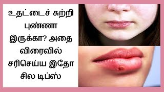 How to Get Rid of Dry Chapped Lips in tamil  Chapped Lips Remedy │Tamil Dear [upl. by Andersen]