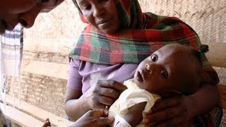 Combating child malnutrition in Darfur Sudan [upl. by Jere]