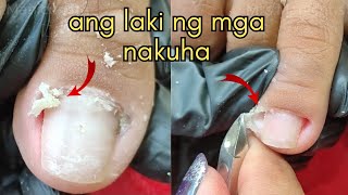 Vlog 1008Dry SkinIngrown Removal PEDICURE 908 [upl. by Darlleen657]