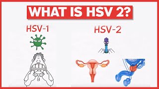 What is HSV 2 [upl. by Ardnic400]