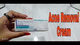 Benzoyl Peroxide 5 Gel Review in Hindi  Acne and Pimples Treatment [upl. by Ziom615]