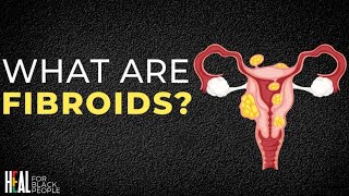 What Are Fibroids [upl. by Ifen475]