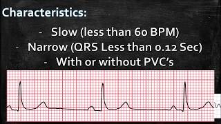 RHYTHM PRACTICE ACLS Rhythm and Tx Sinus Bradycardia [upl. by Auhsej31]