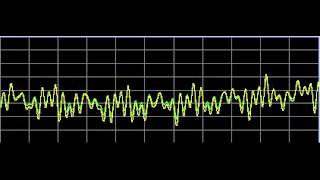 Nervous System Disorders  Rife Frequencies [upl. by Hanny]