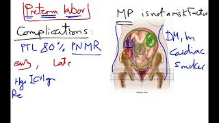 Preterm labor [upl. by Haila702]