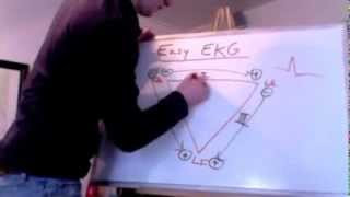 Easy EKG Einthovens Triangle [upl. by Rezzani69]