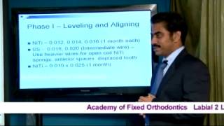 Orthodontic Mechanotherapy  Wire Sequence and Standard Operating Protocol [upl. by Lewes]