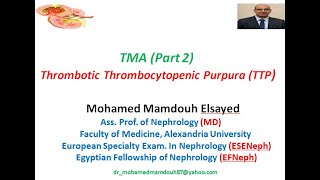 Thrombotic Thrombocytopenic Purpura TTP TMA part 2 [upl. by Ron]