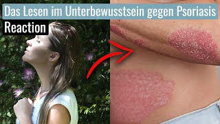 Hilft Lesen im Unterbewusstsein bei Schuppenflechte  Reaction [upl. by Aselehc]