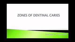 Zone of dentinal caries [upl. by Nyrmak687]