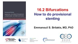 162 Provisional bifurcation stenting  Manual of PCI [upl. by Pradeep865]