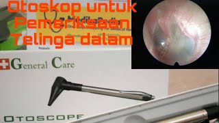 Alat otoskop general Care untuk Pemeriksaan Dalam Telinga Anak dan dewasa [upl. by Aitnecserc]