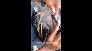 Alopecia Frontal Braids 1 [upl. by Yniatirb]