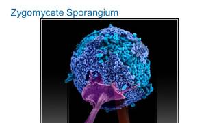 Identification of Filamentous Fungi Hyaline Monomorphic Fungi Part 1 Hot Topic [upl. by Claudette]