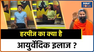 Herpes Disease हरपीज से बचने के 4 योगिकआयुर्वेदिक उपाय जानिए Swami Ramdev से  Yoga Tips [upl. by Lampert]