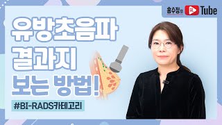 유방초음파 결과지 보는 방법 BIRADS 카테고리 [upl. by Russia]