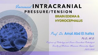 Increased ICP lecture hydrocephalus and edema 1CNS HUشرح محاضرة [upl. by Nnairak]